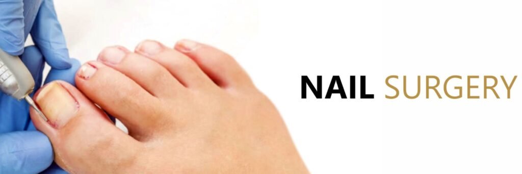 Nail Surgery Nail Surgery