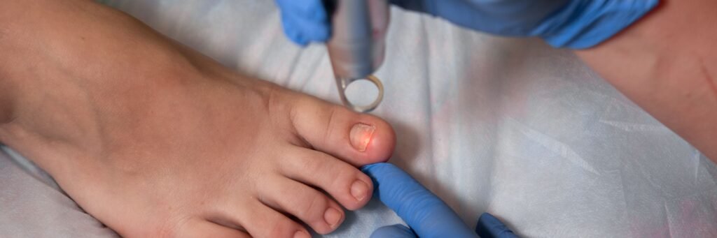 Nail Surgery Nail Surgery