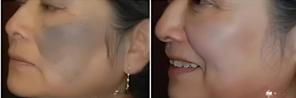 Birthmark Birth Mark